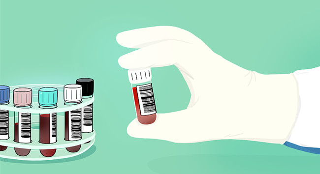 進(jìn)口胎牛血清關(guān)需要什么資質(zhì)? 進(jìn)口胎牛血清關(guān)需要什么資質(zhì)?